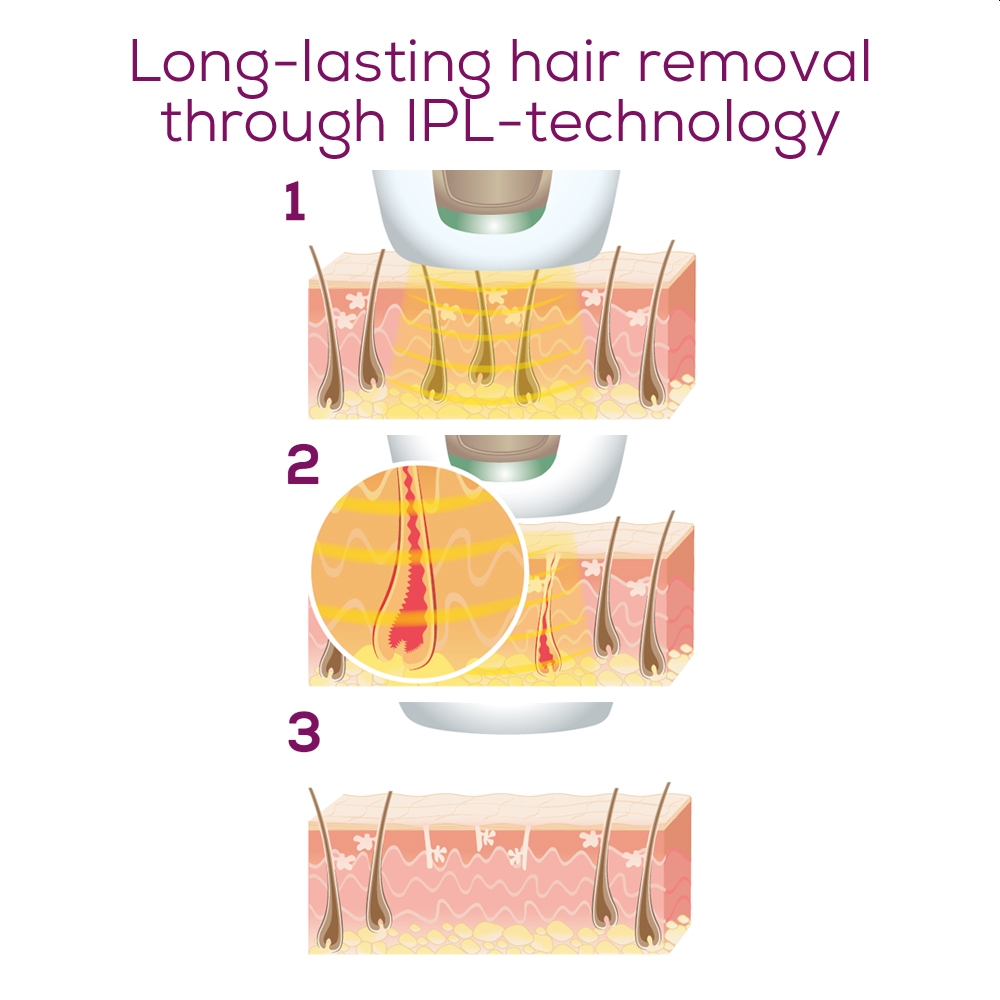 Beurer IPL 8800 Velvet Skin Pro Hair-remover