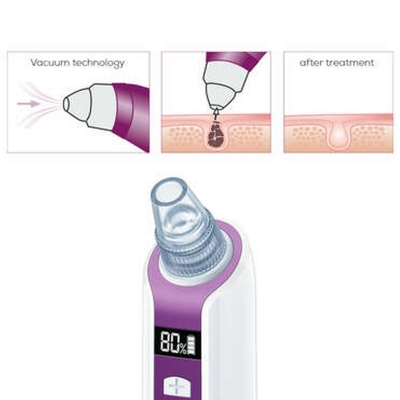 Beurer FC 41 Deep pore cleanser